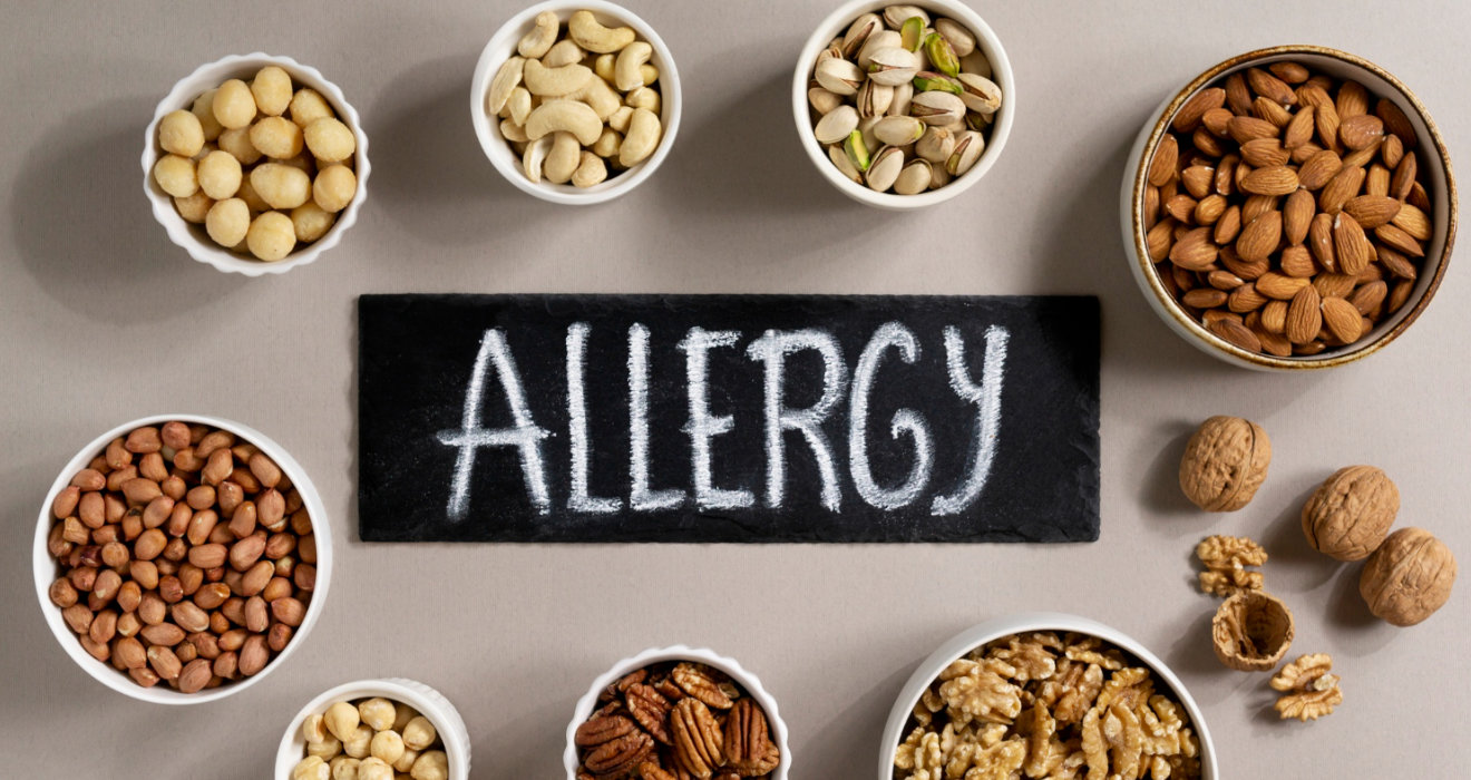 Allergie Alimentaire